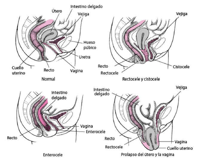 suelo pélvico y vejiga